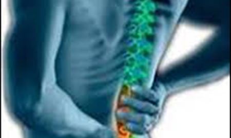 نوع زندگی مردم موجب گسترش فتق دیسک کمر شده است